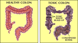 healthyunhealthycolon1.jpg